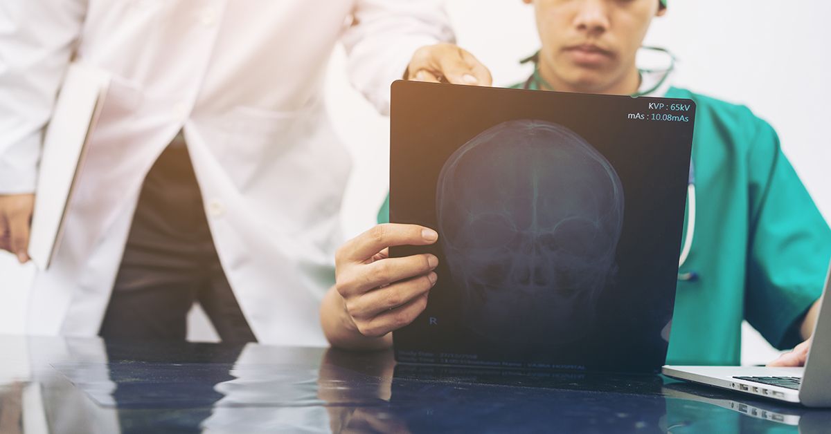 New York Traumatic Brain Injury Lawyers