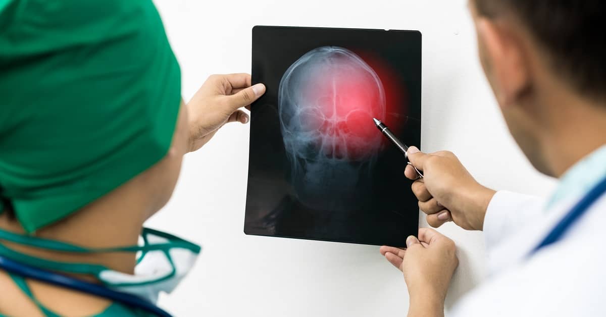 How a Lawyer Can Help with a Brain Injury Lawsuit